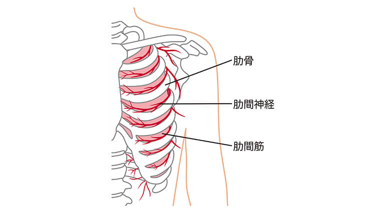 肋間神経痛